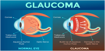 Top Rated Eye hospital in Patna
