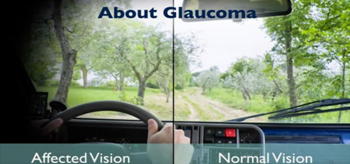 Top Rated Eye clinic in Patna 