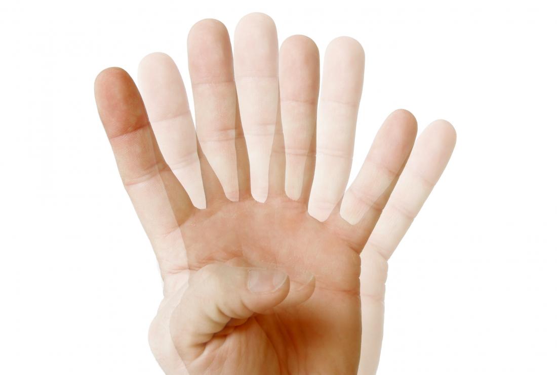 No1 Eye hospital in Patna