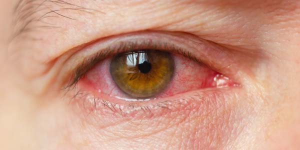 Patliputa Netralay Eye care hospital in Begusarai